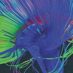 EP 18 WP heade 1170×515